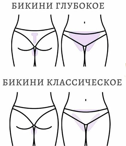 Как бриться без раздражения девушке ноги, зону бикини, подмышки