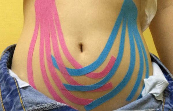 Тейпирование живота и боков для похудения. Схема, как делается, фото, результаты