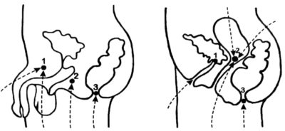 Мула бандха: техника выполнения корневого замка в практике йоги