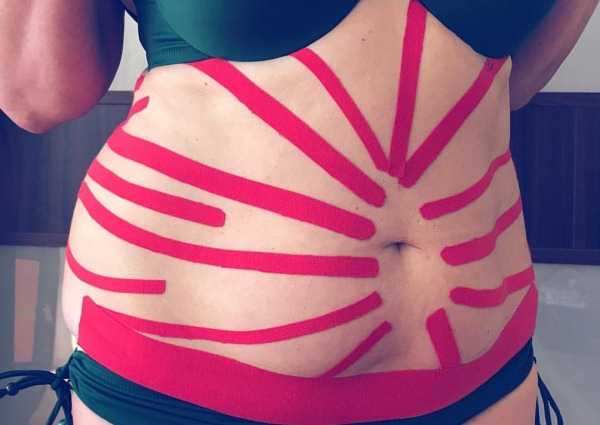 Тейпирование живота и боков для похудения. Схема, как делается, фото, результаты