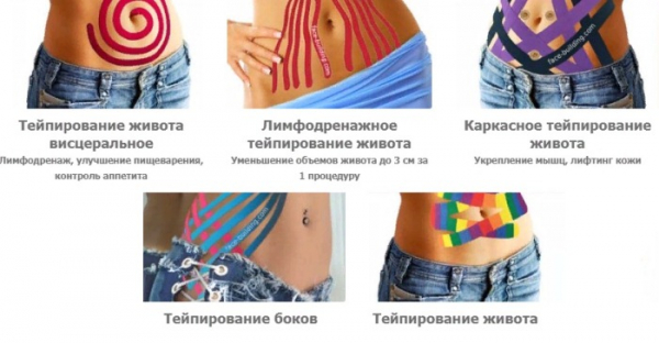 Тейпирование живота и боков для похудения. Схема, как делается, фото, результаты